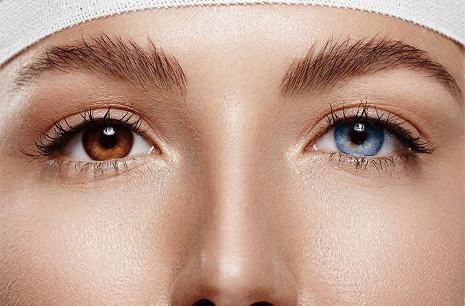 eye color change surgery & correction