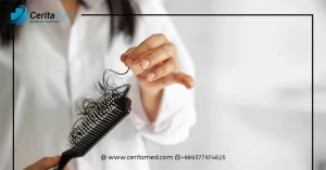 أسباب تساقط الشعر