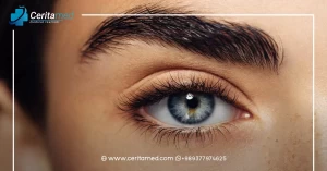 أفضل سن لجراحة تغيير لون العين